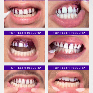 V34 Whitening Strips